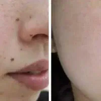 برداشت خال دونه ای 50تومان