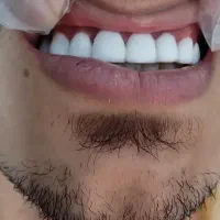 دندانپزشکی با تخفیف ٪40