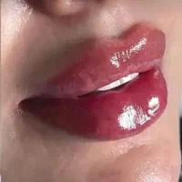 دکتر اکرم آقابیگی پوست مو زیبایی|خدمات آرایشگری و زیبایی|ملایر, |دیوار