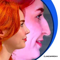 فرصت طلایی عمل بینی