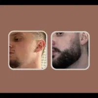 اگه ریشات کم پشته اینجا بیا سریع