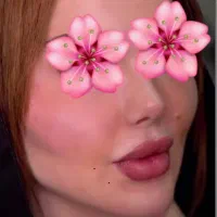 تخفیف ویژه پی ار پیprpفیلرژل بوتاکس کامپوزیت