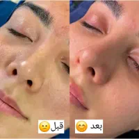 متصدی پاکسازی پوست