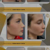 زیبایی/کاشت مو/رفع غبغب/تزریق ژل/ کلینیک در تهران|خدمات آرایشگری و زیبایی|ارومیه, |دیوار