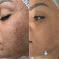 خدمات زیبایی پوست و مو  با جدیدترین تکنیک ها