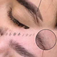 حذف تاتو و خالکوبی با لیزر کیوسوئیچ|خدمات آرایشگری و زیبایی|محمدشهر, محمدشهر|دیوار