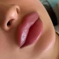 انواع تزریق بدن و صورت فیلربادی ژل و بوتاکس