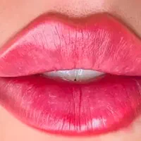 تزریق ژل بوتاکس فیلرصورت و بیکینی در مطب زیبایی