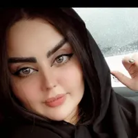 تزریق چربی، بلفاروپلاستی پلک، بینی اتوپلاستی گوش|خدمات آرایشگری و زیبایی|تهران, ستارخان|دیوار
