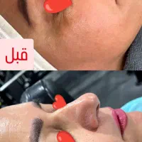 درمان تخصصی پوست همراه با افر ویژه تقویت ریشه مو
