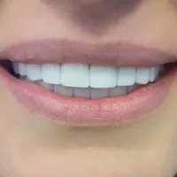 خدمات زیبایی کامپوزیت با هزینه جیب شما