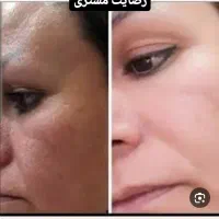 کرم آیدن معجزه خاورمیانه