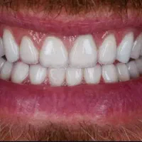 جشنواره شرایط اقساطی دندان پزشکی