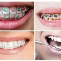بلیچینگ لمینت' کامپوزیت' اندو/ ایمپلنت بهترین برند