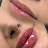 آف ژل بوتاکس مناسبت روز زن|خدمات آرایشگری و زیبایی|ایذه, |دیوار