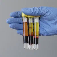 مزو تراپی .پی ار پی prp