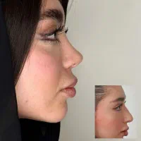 جراحی تخصصی بینی،تخغیف بی نظیر