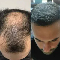 رویش نوین