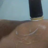 جشنواره پلاژن تراپی صورت و بدن|خدمات آرایشگری و زیبایی|شیراز, قصرالدشت|دیوار