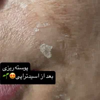 فیشال حرفه ای ۳۵۰ محدود،پاکسازی پوست ودرمان تخصصی|خدمات آرایشگری و زیبایی|صدرا-فارس, فاز ۱|دیوار
