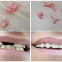 لابراتوار دندانسازی(نیودنت Newdent)|خدمات آرایشگری و زیبایی|کاشمر, |دیوار