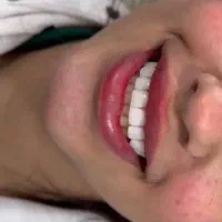 کامپوزیت هر فک ۸ میلیون