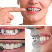 ارتودنسی تخصصی فقط با 10 میلیون