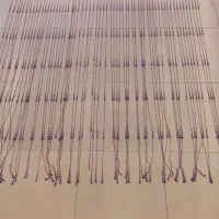 پرده مرواریدی