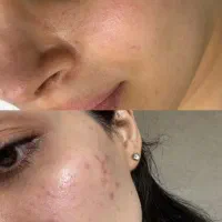 فشیال تخصصی|خدمات آرایشگری و زیبایی|تربت جام, بیست متری منبع آب|دیوار