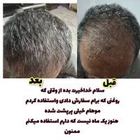 اکسیرمعجزه گررشدموی سرشما