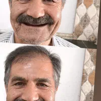 ساخت انواع دندانهای مصنوعی و متحرک|خدمات آرایشگری و زیبایی|شیراز, پودنک|دیوار
