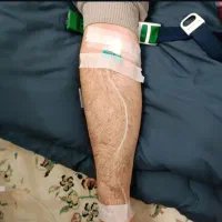 تزریقات در منزل،وصل سرم در منزل همرا سرم و آمپول|خدمات آرایشگری و زیبایی|فردیس, منظریه|دیوار