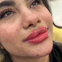 جشنواره ژل و بوتاکس|خدمات آرایشگری و زیبایی|شیراز, دلجو|دیوار