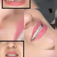 خدمات دندانپزشکی آریا دنت شرایط ویژه افتتاحیه