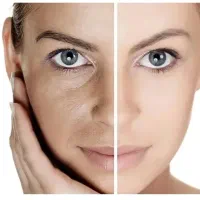 راهنمایی کنید جوانسازی پوست