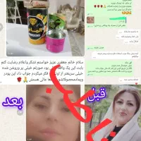 تغییر و زیبایی|حراج|خرمشهر, |دیوار