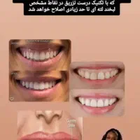 فشیال تخصصی تحت نظرپزشک..مشاوره مراقبت های پوست مو