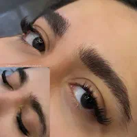 مدل میکروبلیدینگ