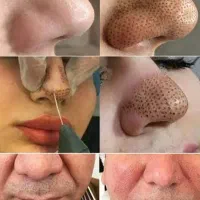 جشنواره تزریق ژل و بوتاکس در مطب با۴۰درصد تخفیف|خدمات آرایشگری و زیبایی|کرمانشاه, |دیوار