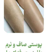 جشنواره پاییزی لیزر با دستگاه کندلا آمریکایی ۲۰۲۴|خدمات آرایشگری و زیبایی|اصفهان, سعادتآباد|دیوار