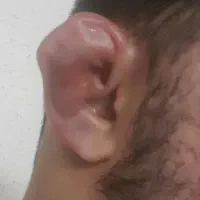شکستن گوش ،فرمدهی تخصصی و پلمپ گوش|خدمات زیبایی و سلامت|تهران, استاد معین|دیوار