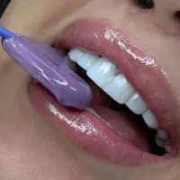 کامپوزیت دندان فکی ۸ میلیون با ضمانت ده ساله|خدمات آرایشگری و زیبایی|قزوین, |دیوار