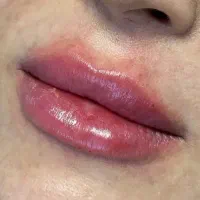 تخفیف ویژه افتتاحیه مطب زیبایی