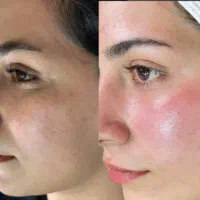 تخفیف 50%پاکسازی پوست،بافت مو،لیفت ابرو