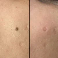 تخفیفات ۵۰ درصدی ژل ،آنزیم بینی ، بوتاکس ، پاکسازی|خدمات آرایشگری و زیبایی|کرمانشاه, |دیوار
