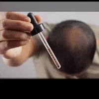 روییش مجددمو با قویترین محلول تخصصی وکاملاگیاهی