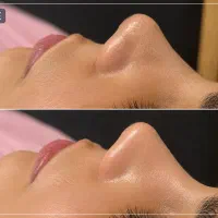مدل فیشال تخصصی