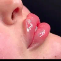 جشنواره تخصصی  ژل و بوتاکس باقیمت استثنایی محدود