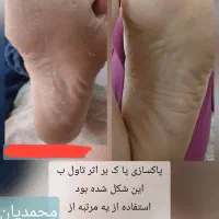 درمان خشکی و ترک پا|آرایشی، بهداشتی، درمانی|تربت جام, امام|دیوار