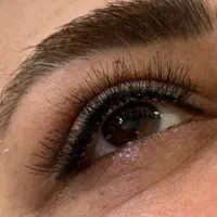 کاشت هیدن مژه